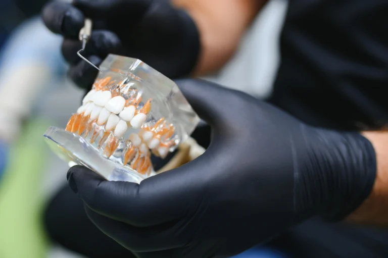 dolore dopo impianto dentale